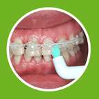 ApaCare Sonic 3D Sensitive vieno danties šepetėlio galvutės, 2 vnt.